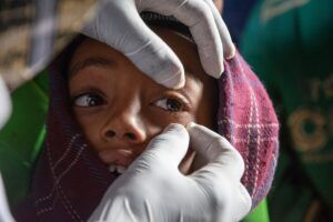 Un operatore sanitario effettua una visita oculistica ad un ragazzo dei Paesi in via di Sviluppo (fonte: CMB Italia).