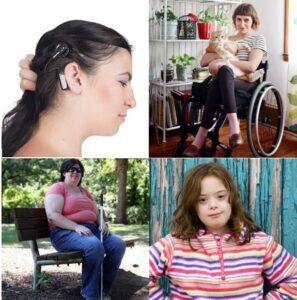 Collage di quattro immagini di donne con disabilità: una donna sorda con impianto cocleare, una in sedia a rotelle con un bel gatto in braccio, una cieca con il bastone bianco seduta su una panchina all’aperto, ed una con sindrome di Down con una maglia a strisce di diversi colori e le mani sui fianchi.